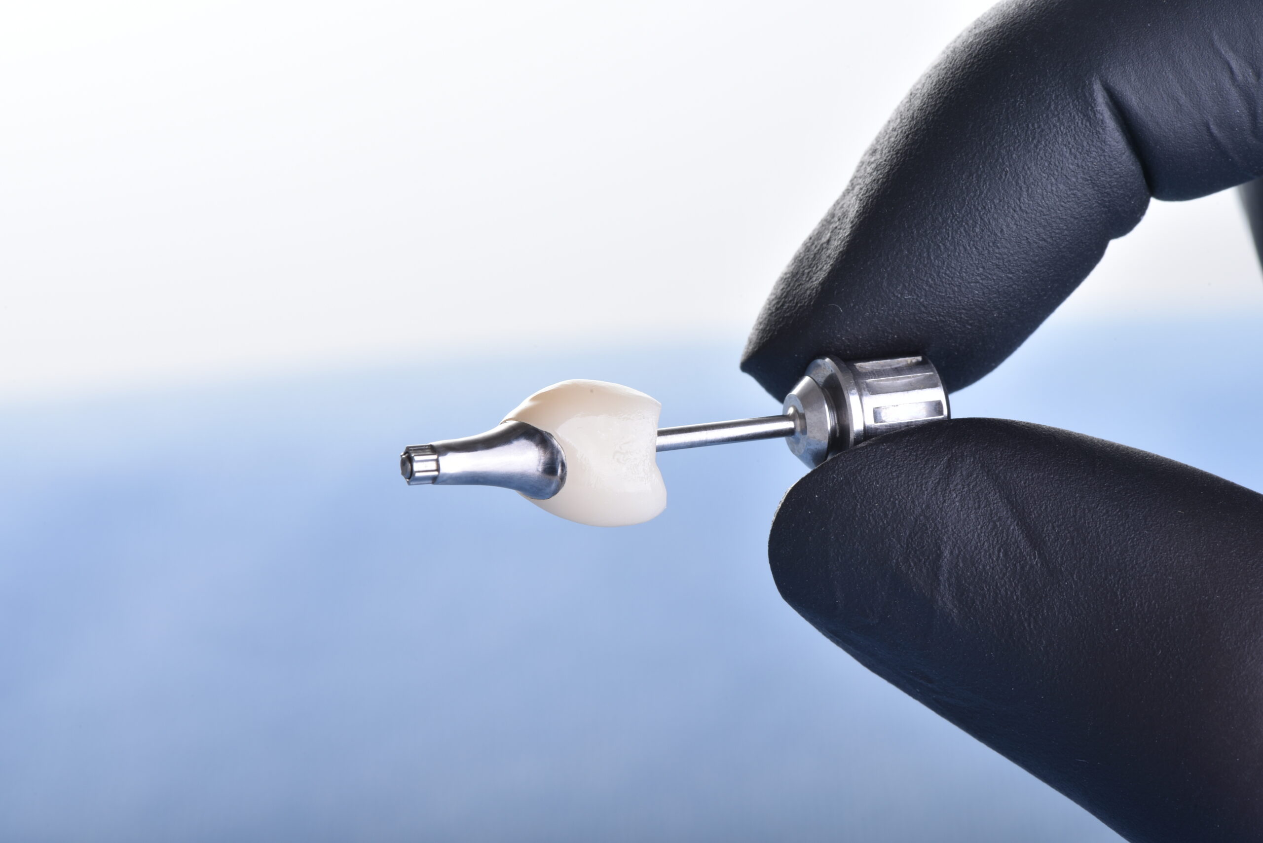 名古屋　インプラントが向いている人・向いていない人