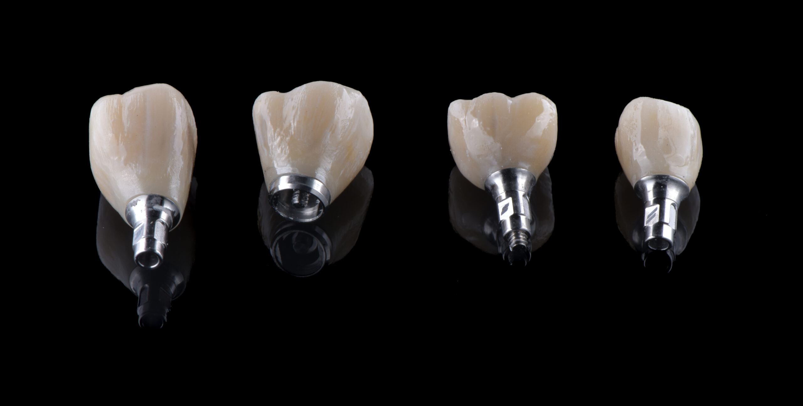 名古屋　インプラントの構造