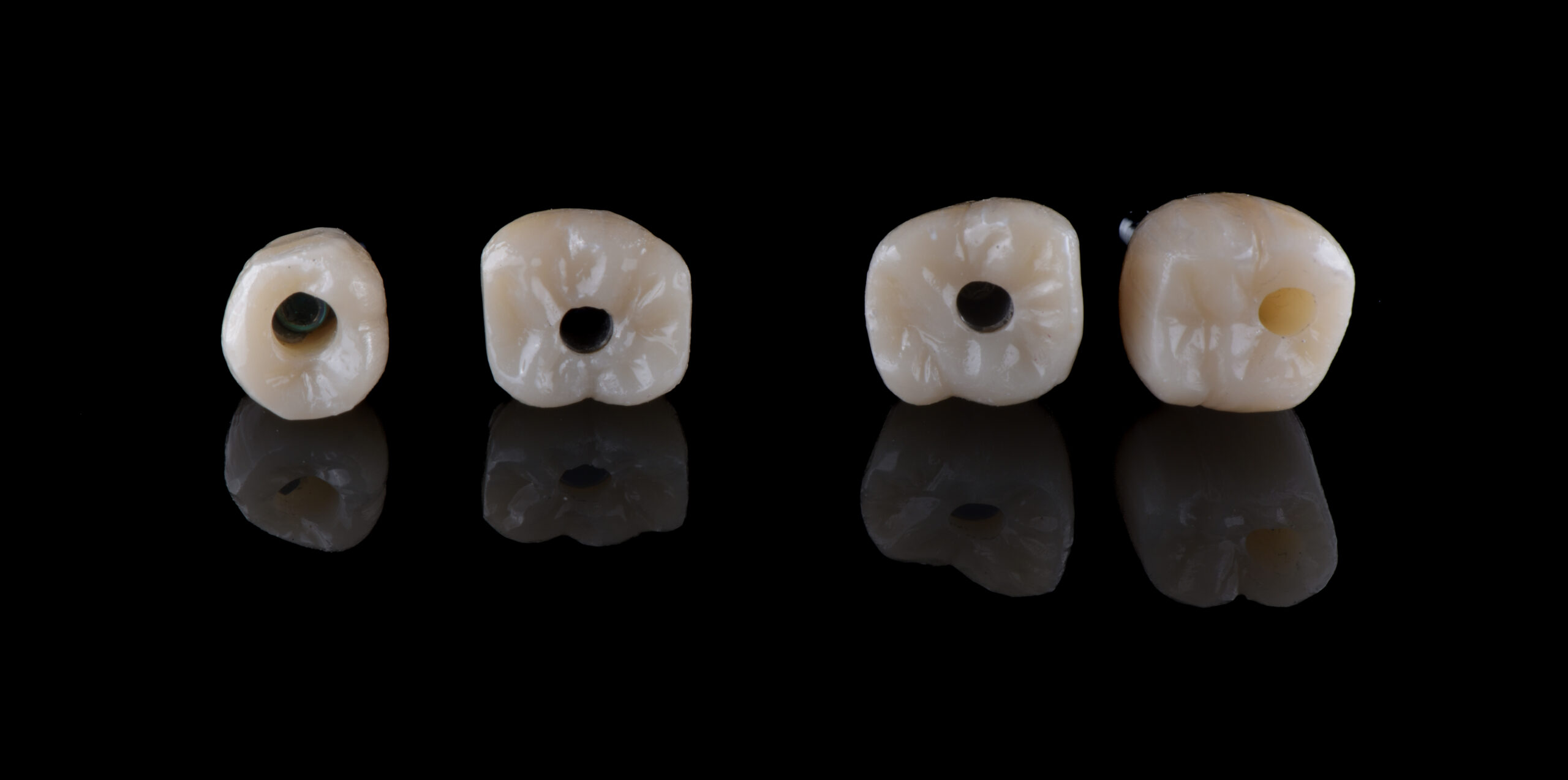 名古屋のインプラント費用に差が出る理由