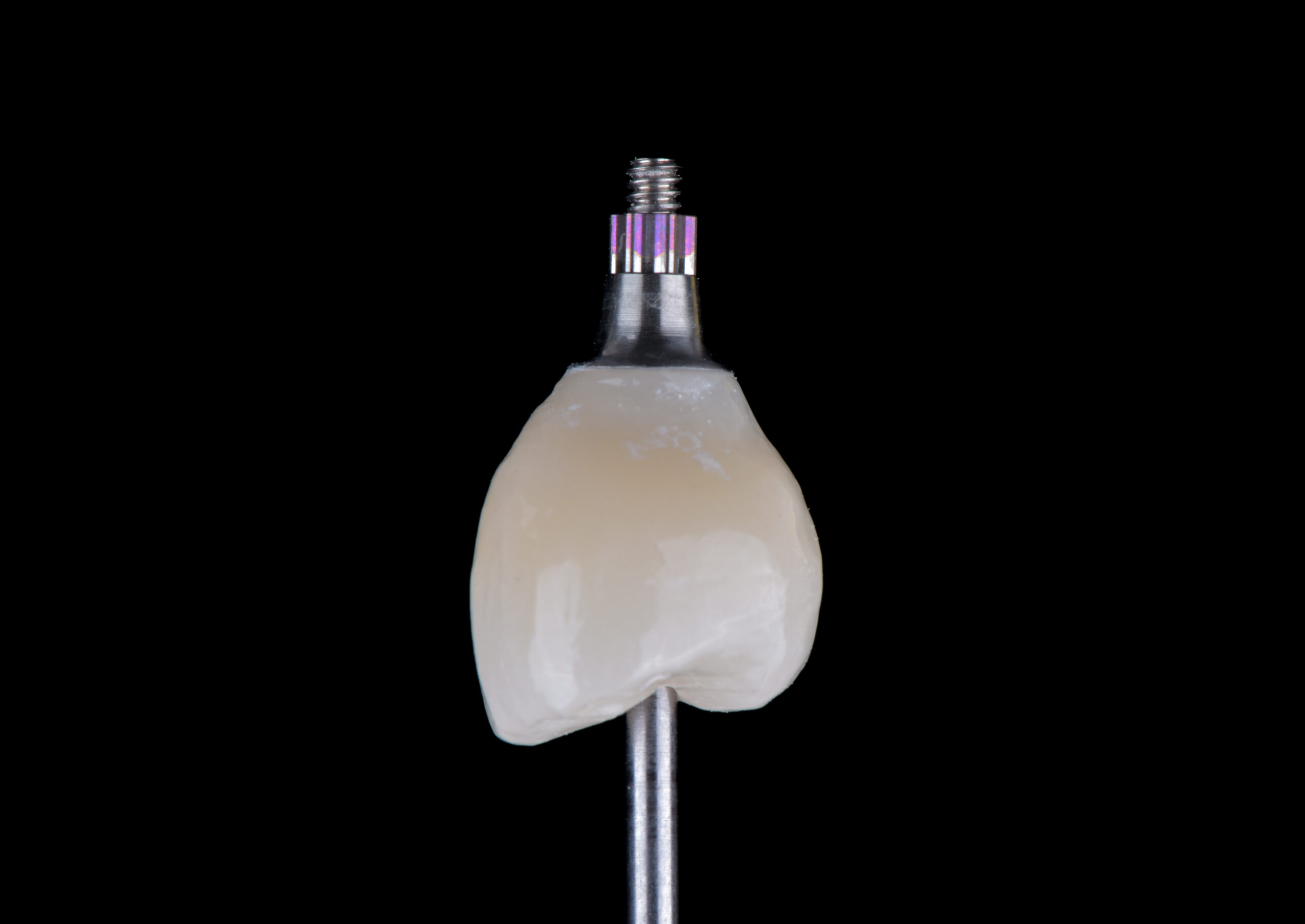 名古屋 インプラント｜後悔しないために最初に整理しておきたいこと