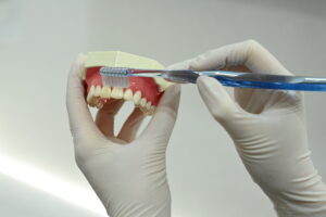 名古屋　インプラント