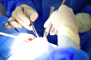 名古屋　インプラント