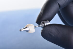 名古屋　インプラント