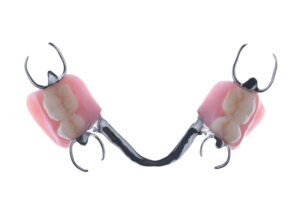 名古屋　インプラント