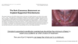 名古屋 インプラント