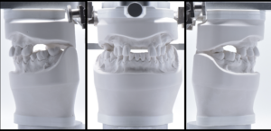 名古屋 栄 伏見 インプラント