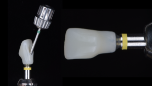 名古屋　インプラント