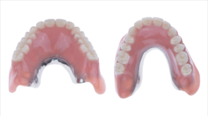 名古屋　インプラント