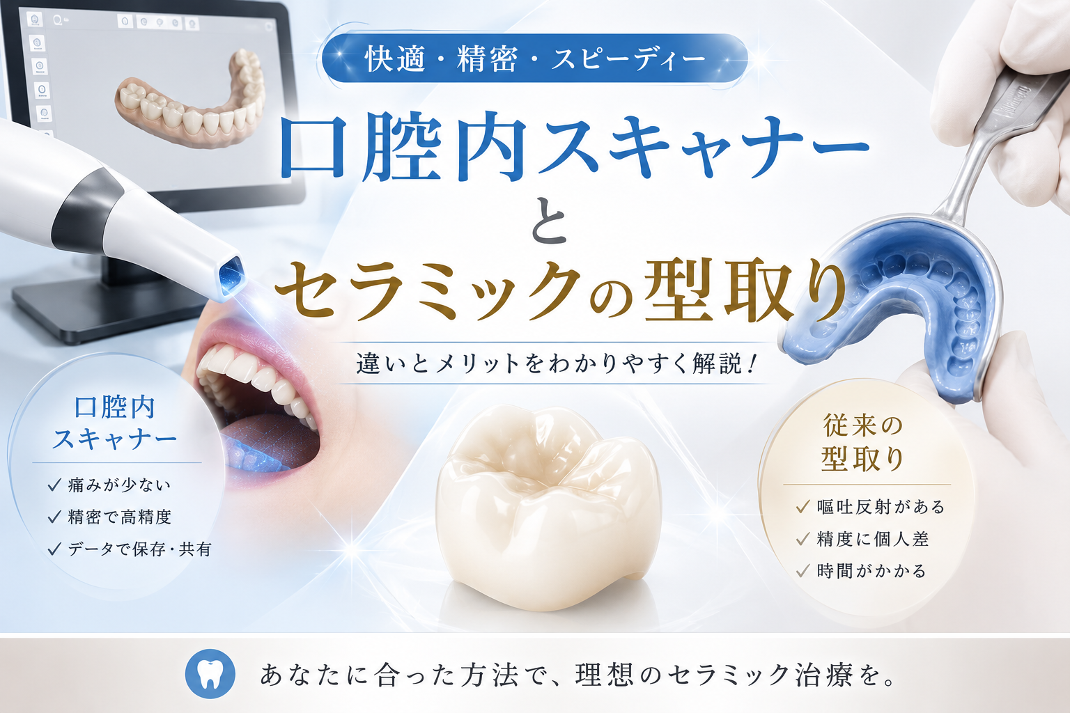 口腔内スキャナーとセラミックの型取り｜名古屋で精度を見極める