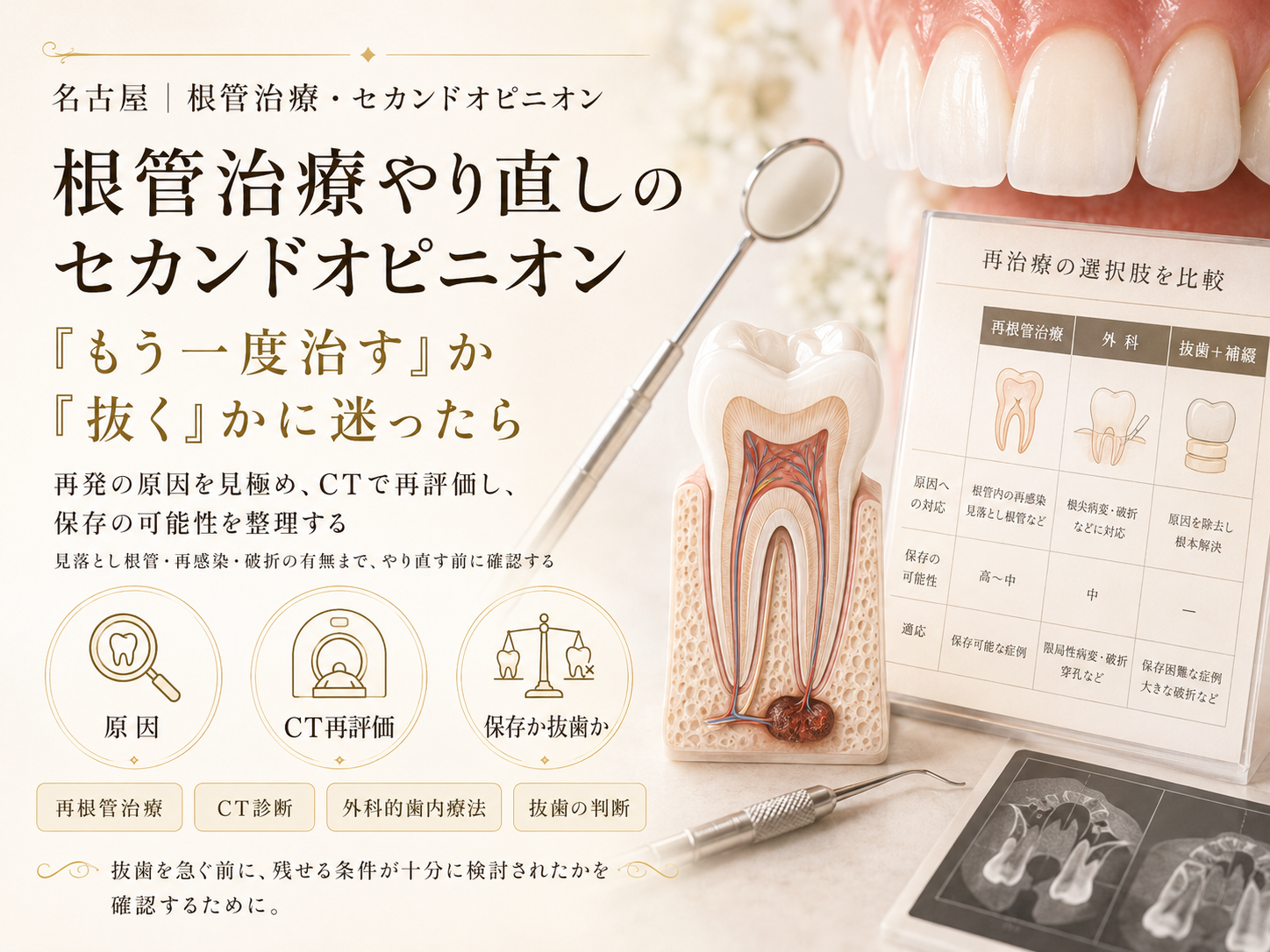 根管治療やり直しのセカンドオピニオン｜名古屋で「もう一度治す」か「抜く」かに迷ったら