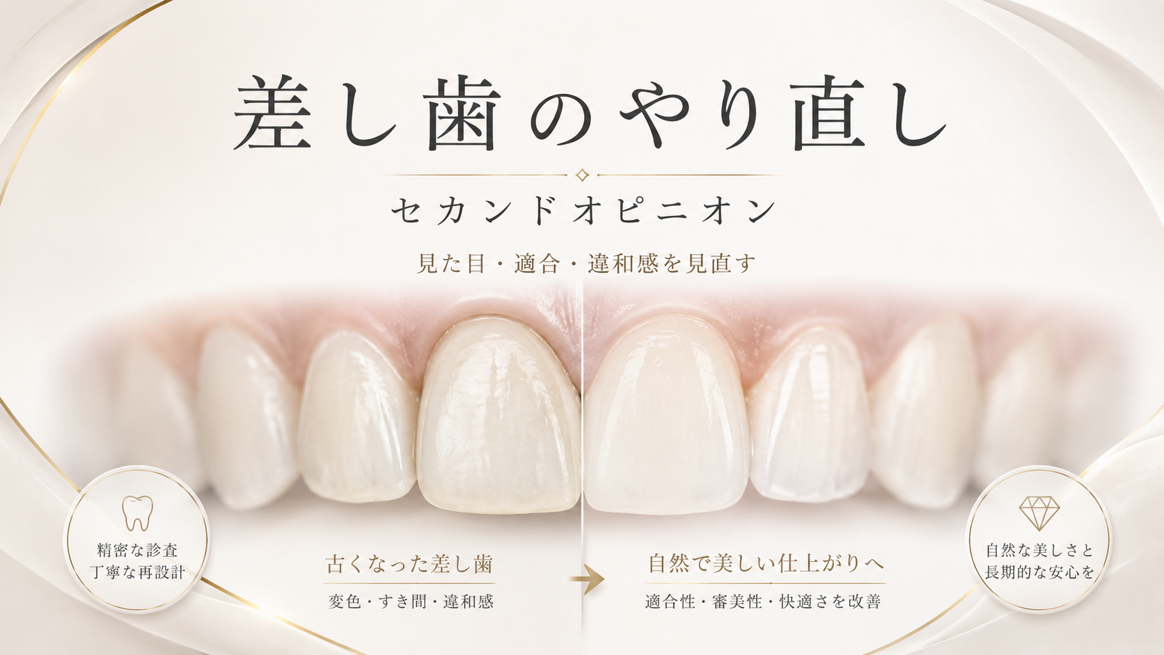 差し歯 やり直し セカンドオピニオン｜変色・歯ぐきの黒ずみ｜名古屋