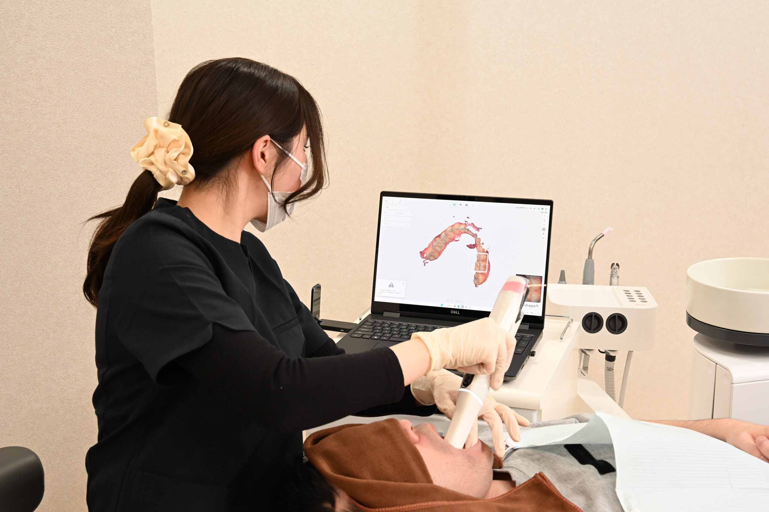 口腔内スキャナーによるデジタルスキャン｜オールオン4の上部構造の適合精度向上｜名古屋Eden Dental Office