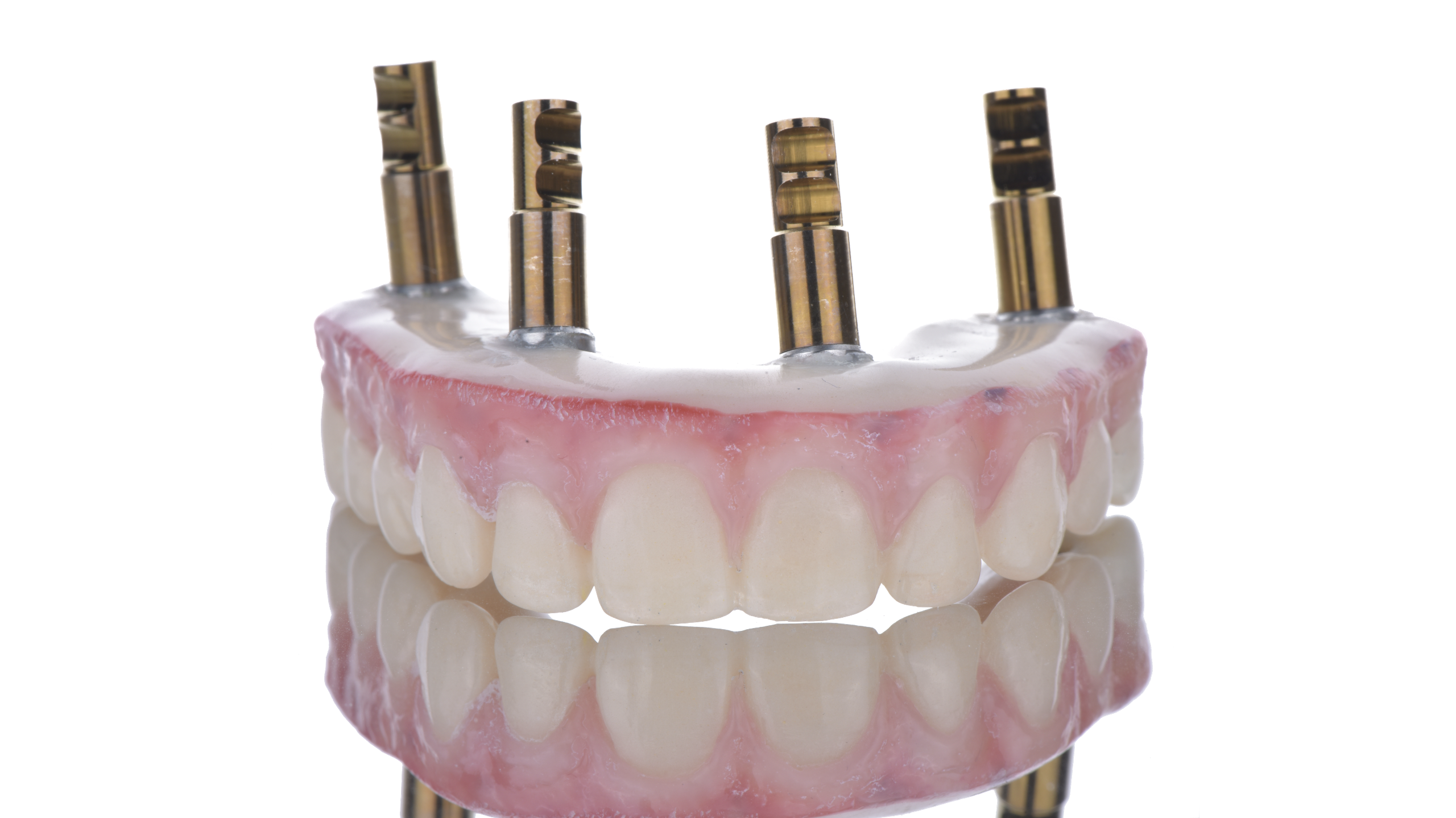 即時荷重用の仮歯（Same Day Teeth）｜オールオン4の手術当日装着・12本分固定式仮歯｜名古屋Eden Dental Office