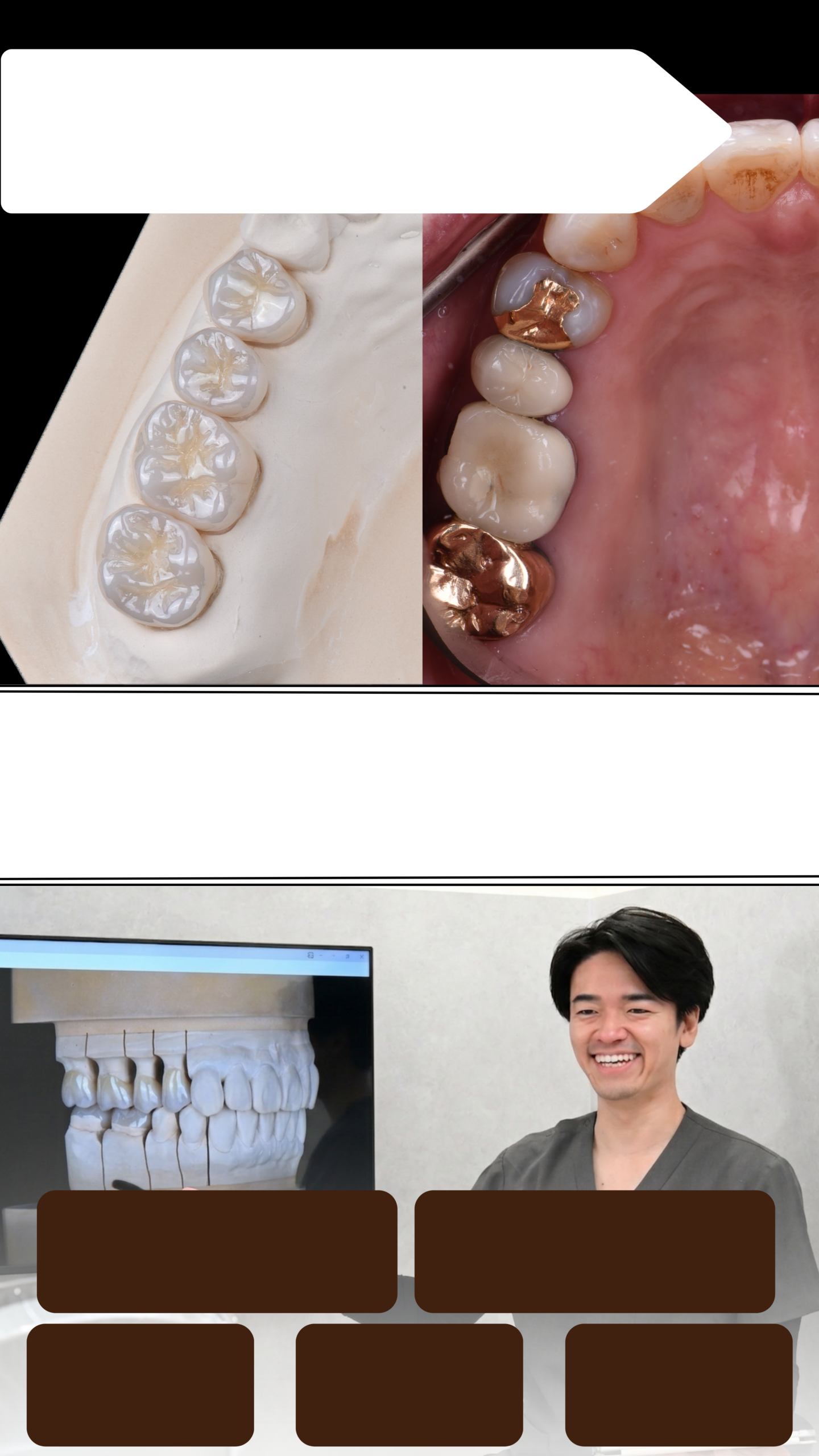 名古屋・伏見 Eden Dental Office｜他院で受けた治療のやり直し・再治療