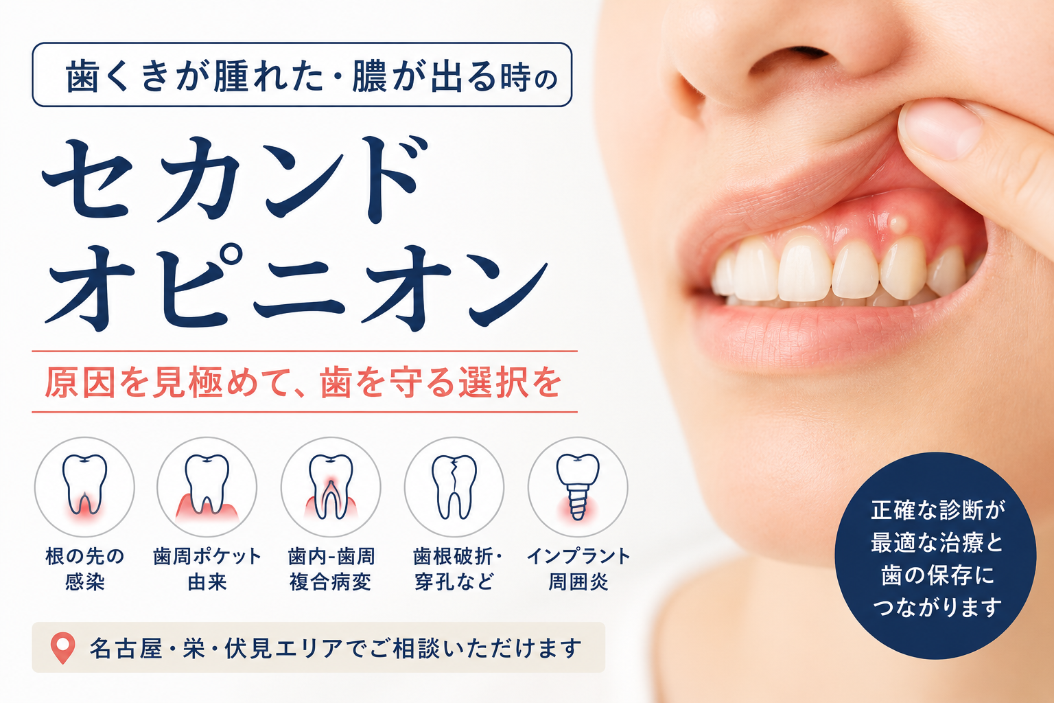 歯ぐきが腫れた・膿が出る時のセカンドオピニオン
