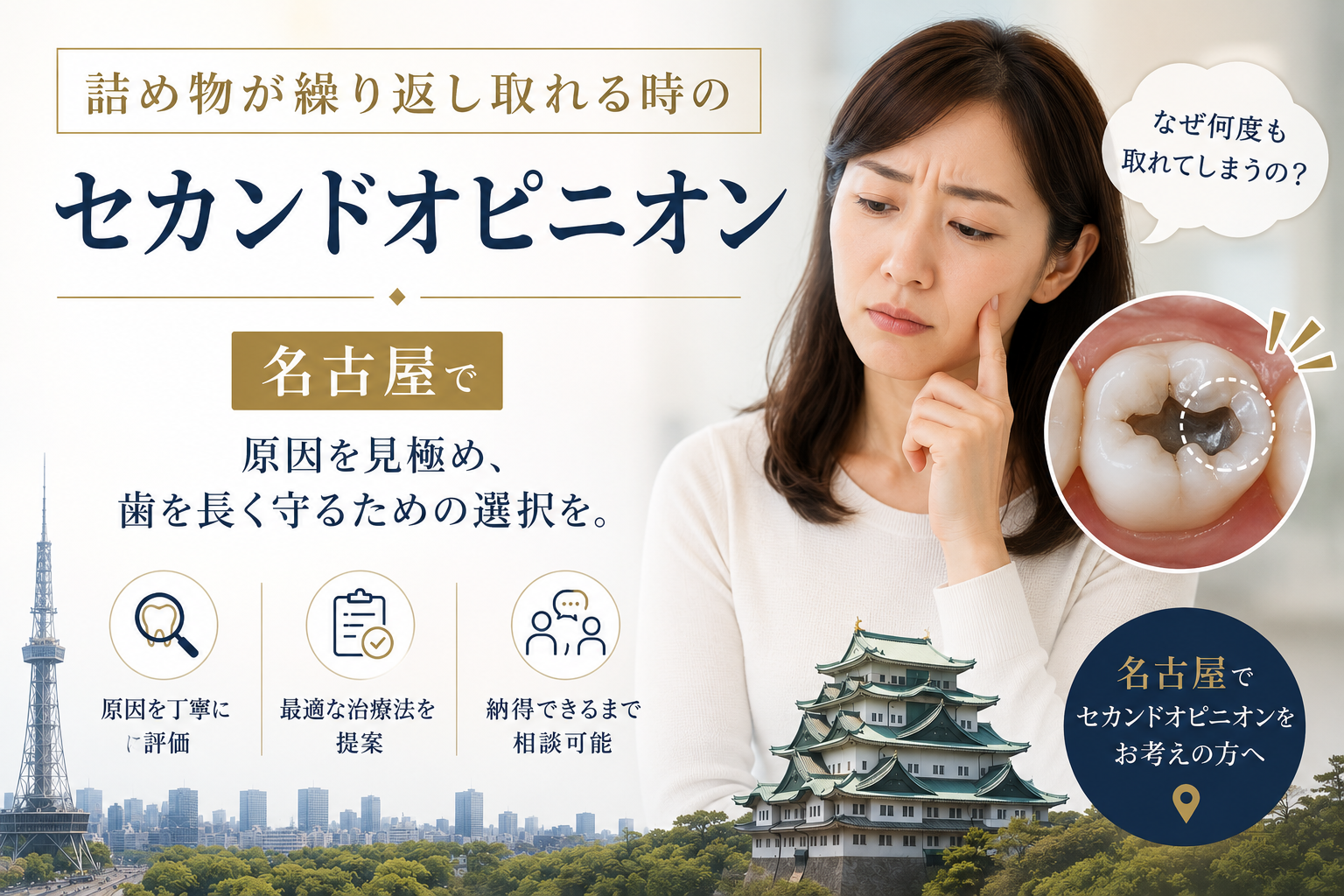 詰め物が繰り返し取れる時のセカンドオピニオン|名古屋