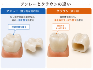 名古屋　セラミック