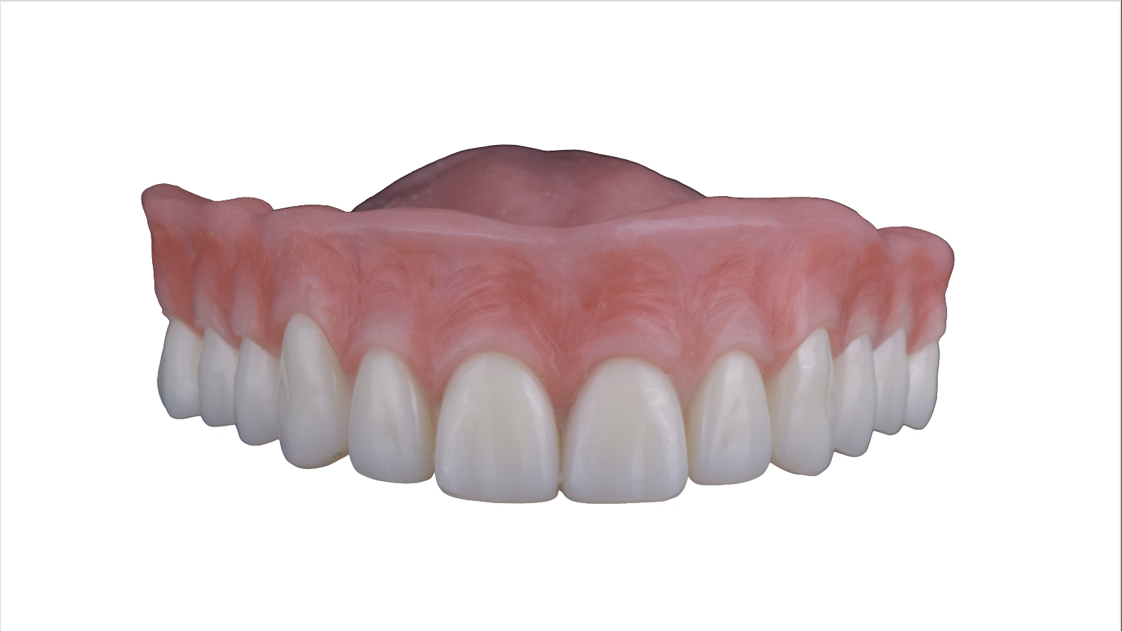 今お使いの入れ歯を活かせるかを、設計から見極めます|名古屋・伏見 Eden Dental Office