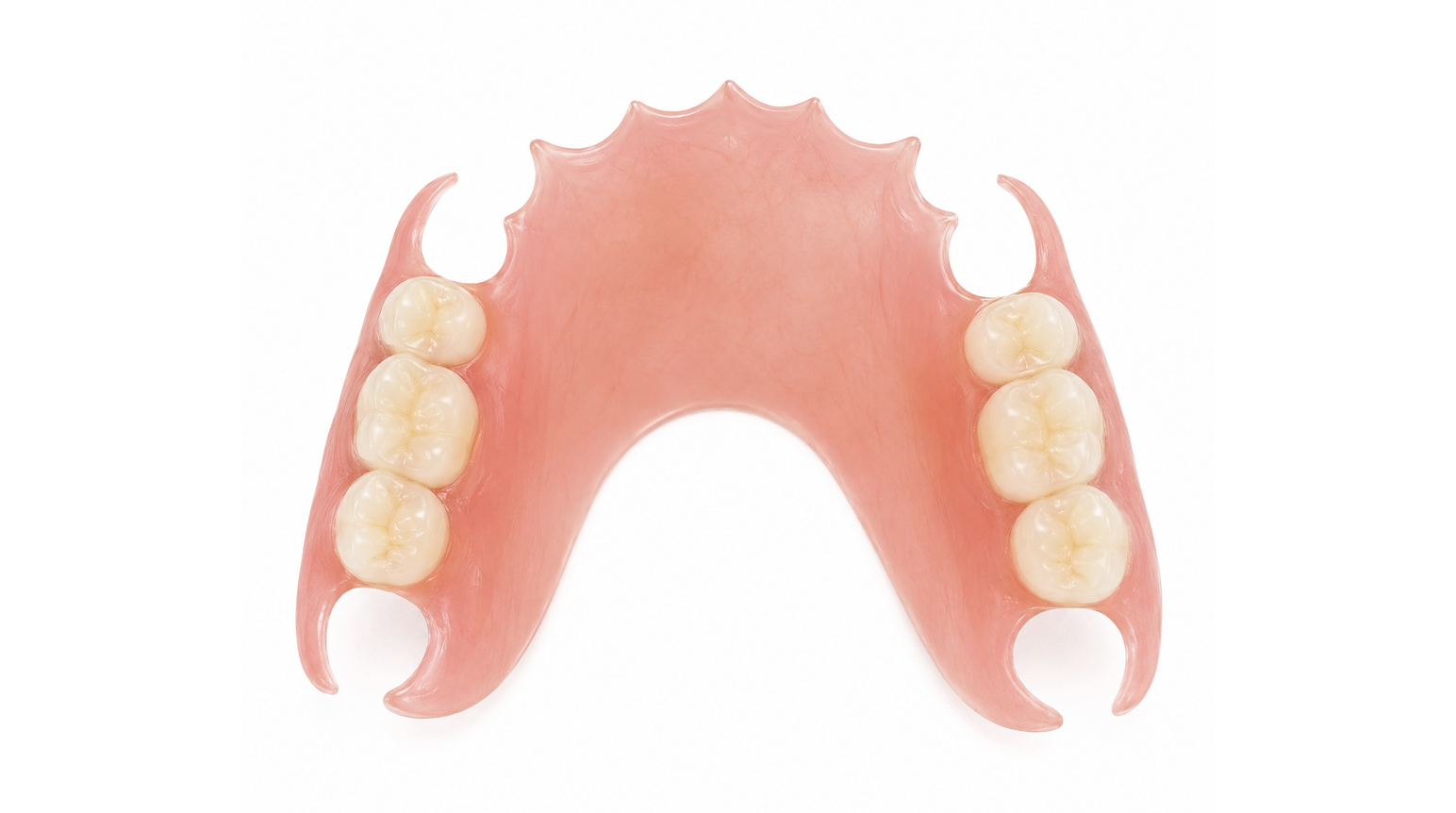 ノンクラスプデンチャー(バネが見えにくい入れ歯)|名古屋・伏見 Eden Dental Office