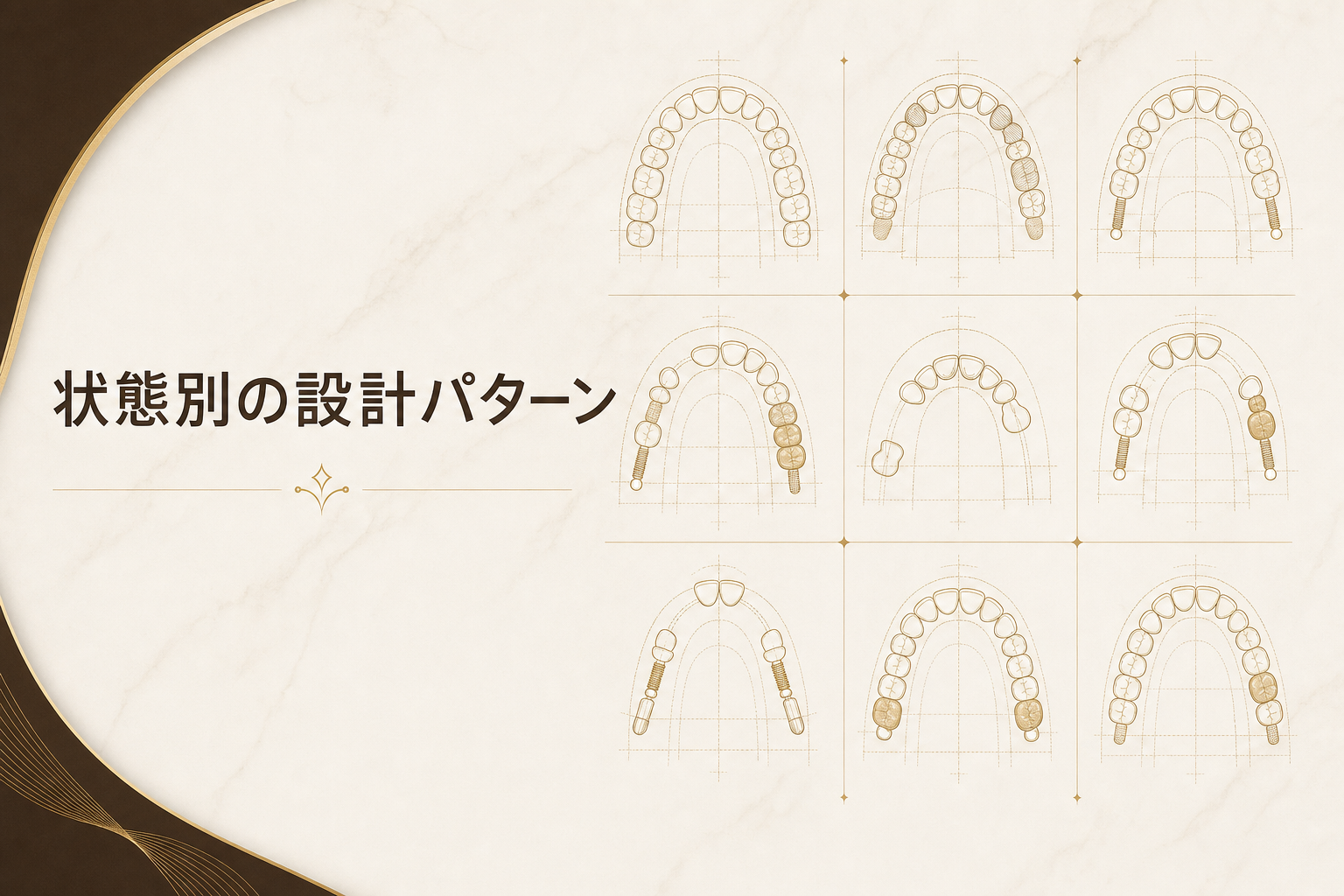 全顎治療のパターン別設計｜名古屋の状態別フルマウス【完全ガイド】