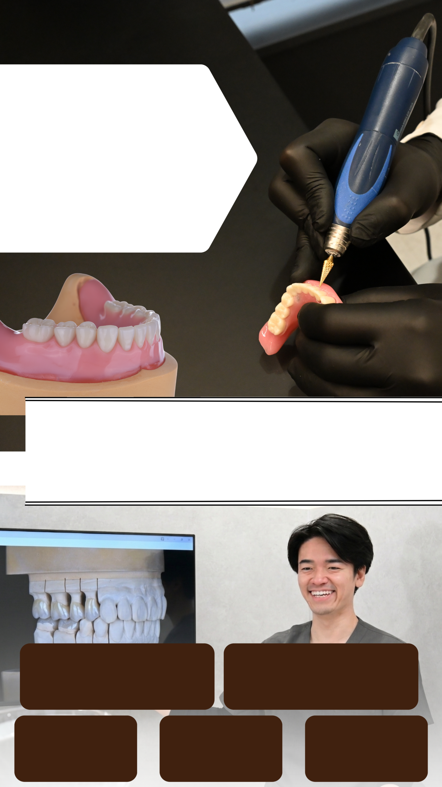 名古屋・伏見の入れ歯・精密入れ歯｜Eden Dental Office