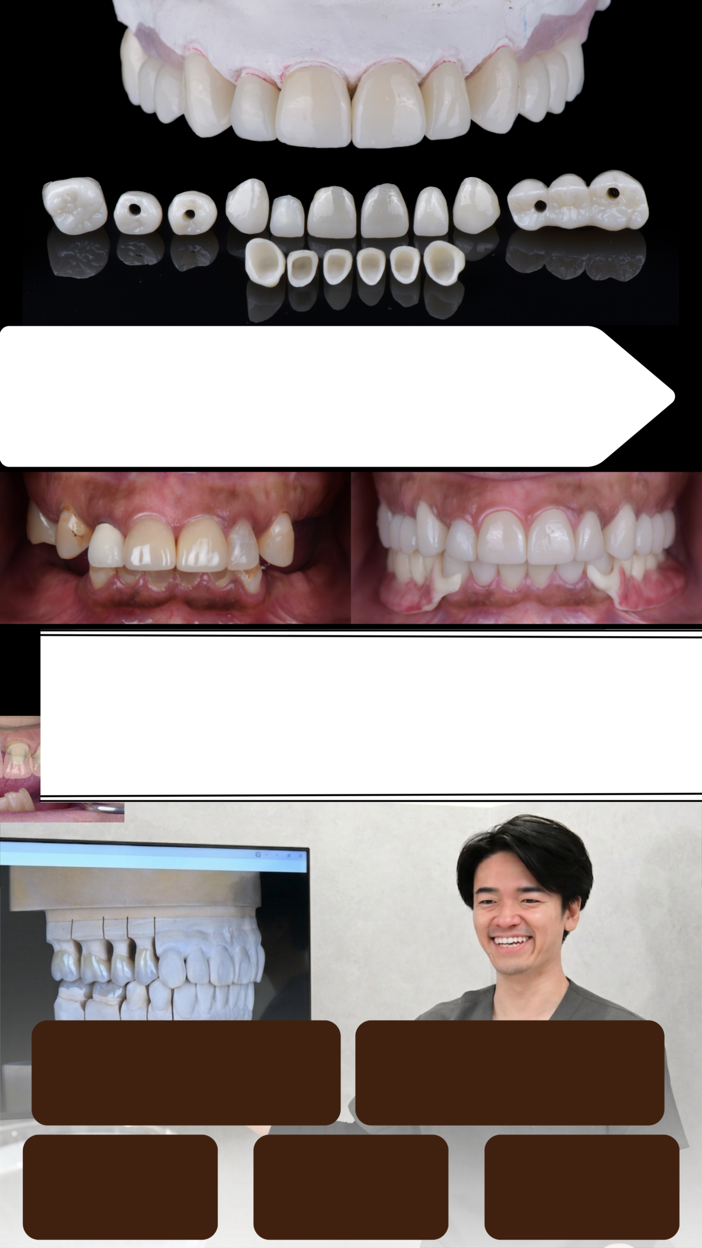 名古屋・伏見のフルマウス治療（全顎治療）｜Eden Dental Office