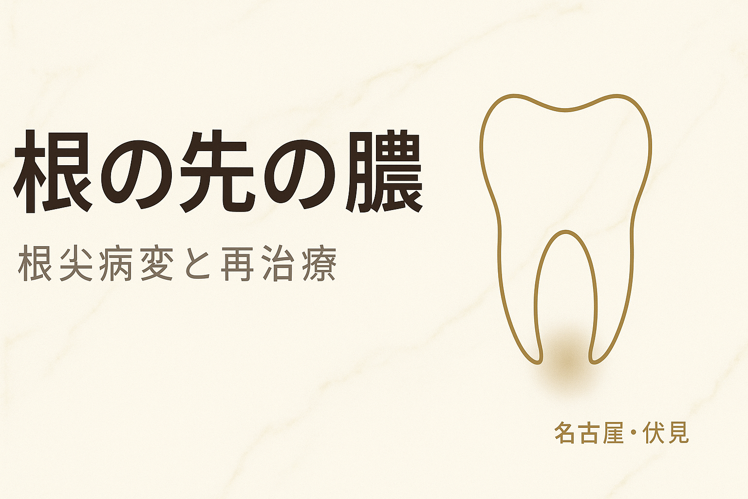 根の先の膿（根尖病変）と再治療