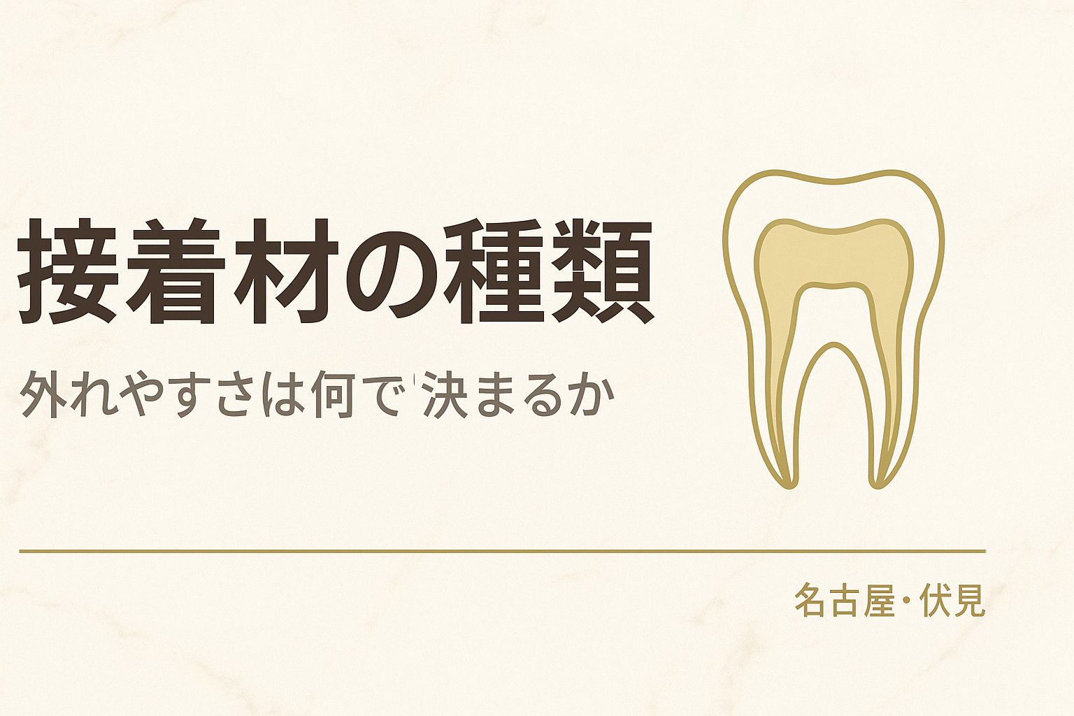 接着（セメント）の種類と外れやすさ
