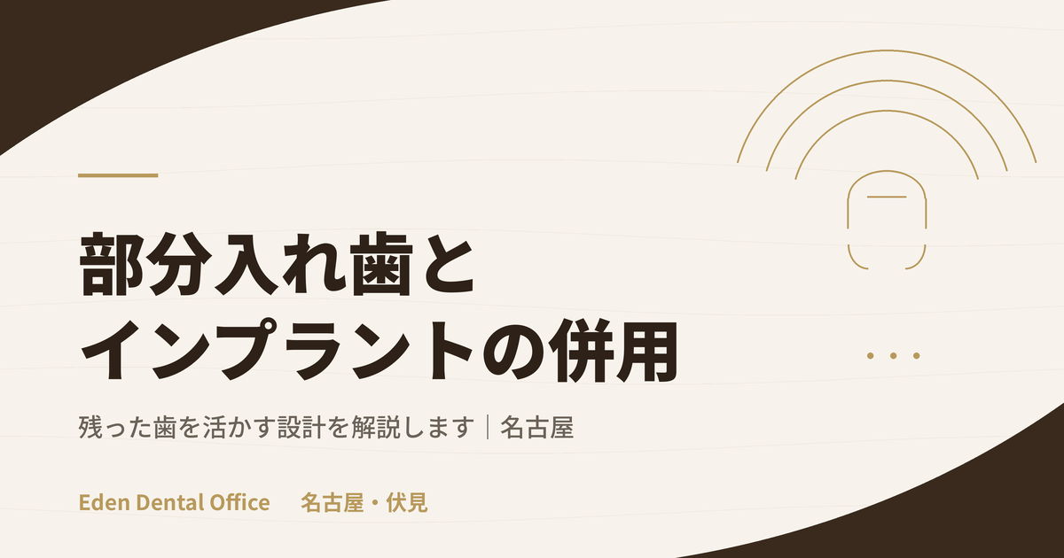 残っている歯がある方の部分入れ歯×インプラント併用設計