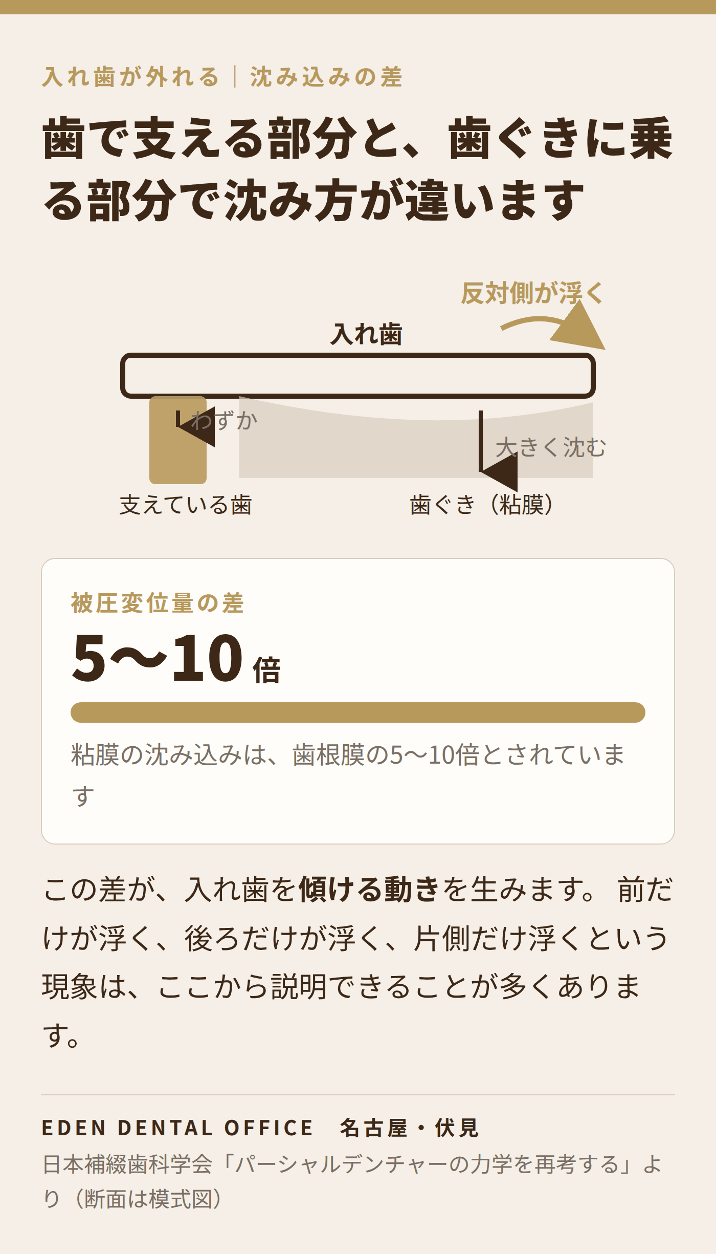 粘膜と歯で沈み方が違う|名古屋エデンデンタルオフィス