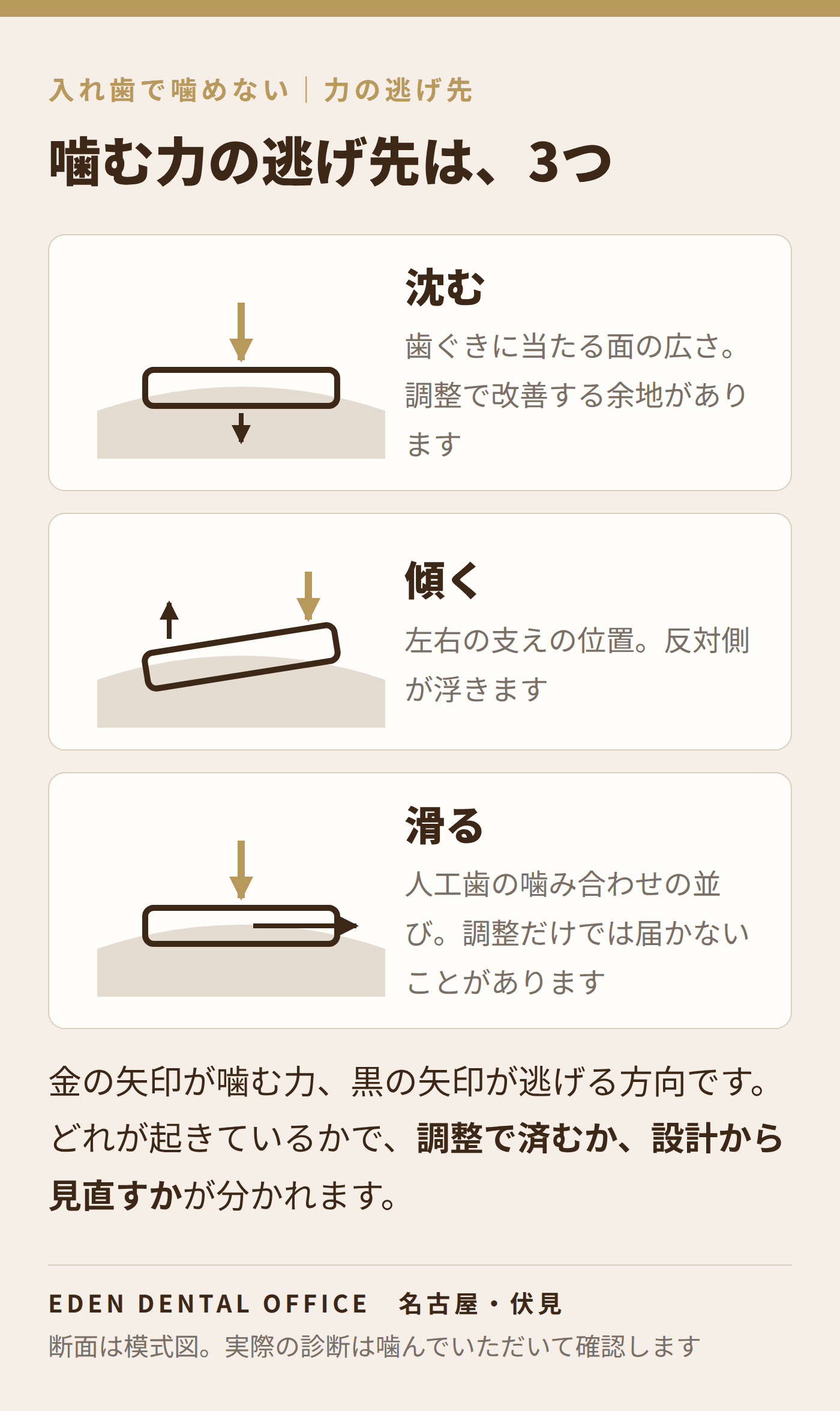 噛む力がどこへ逃げるか|名古屋エデンデンタルオフィス