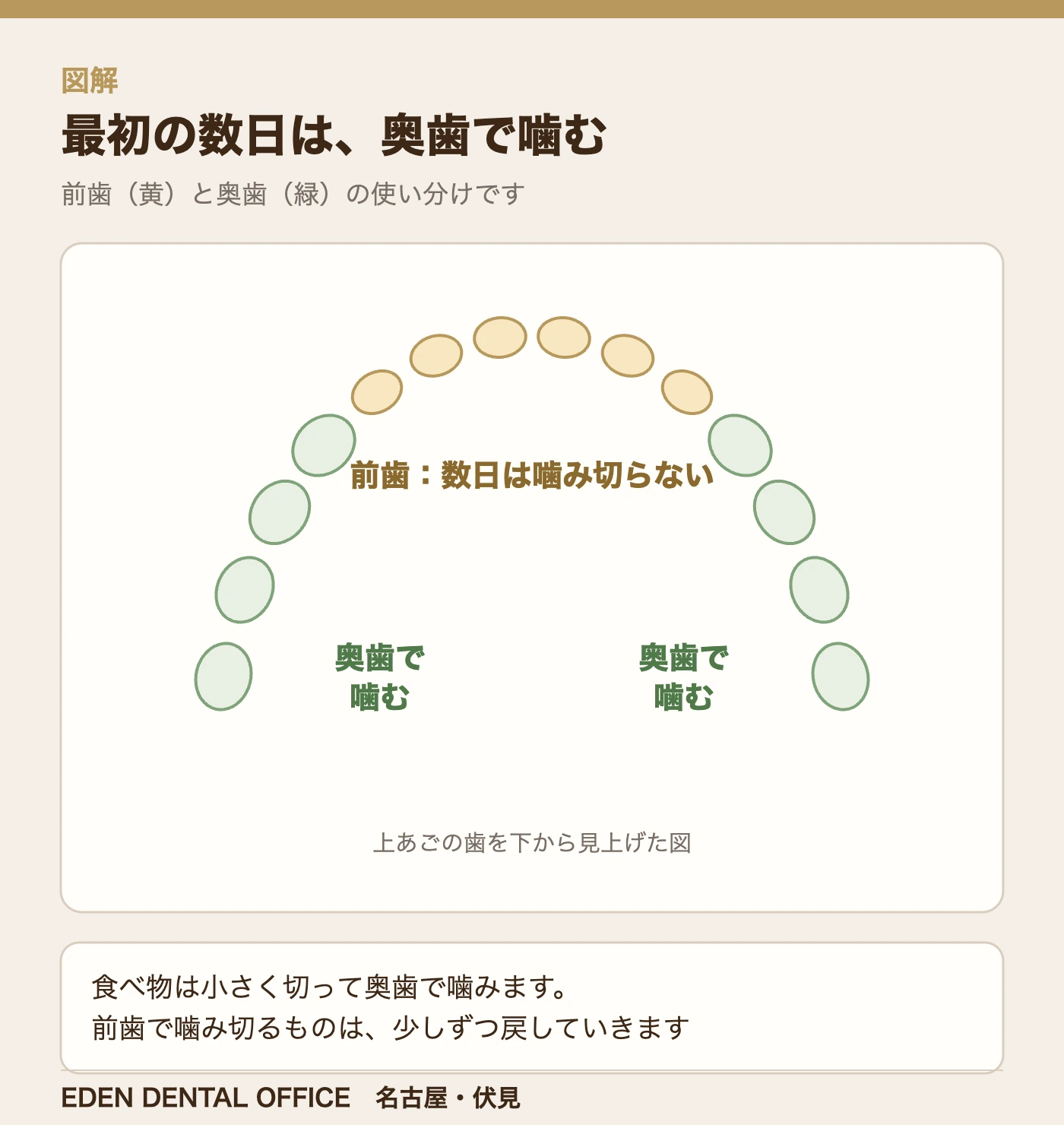 最初の数日は、奥歯で噛む|名古屋エデンデンタルオフィス
