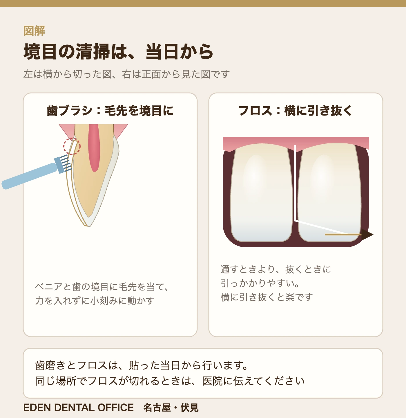 境目の清掃は、当日から|名古屋エデンデンタルオフィス