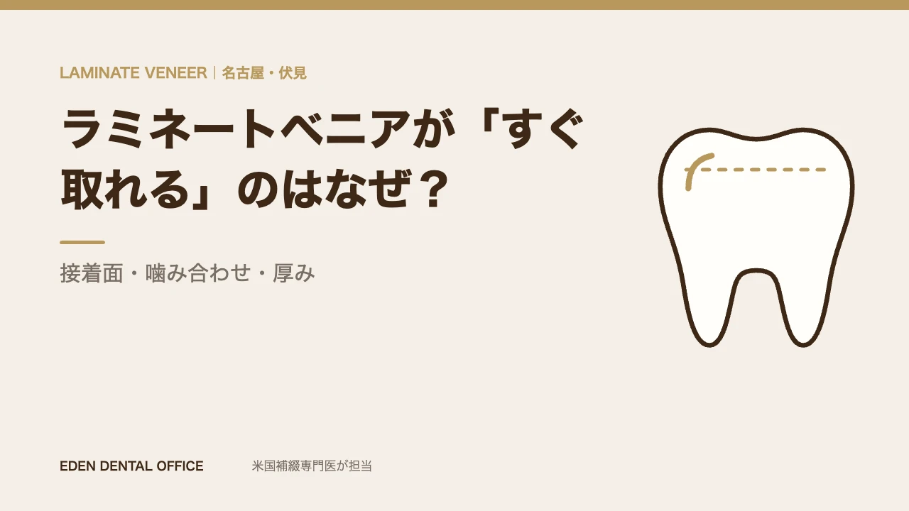 ラミネートベニアが「すぐ取れる」のはなぜ？｜接着面・噛み合わせ・厚み