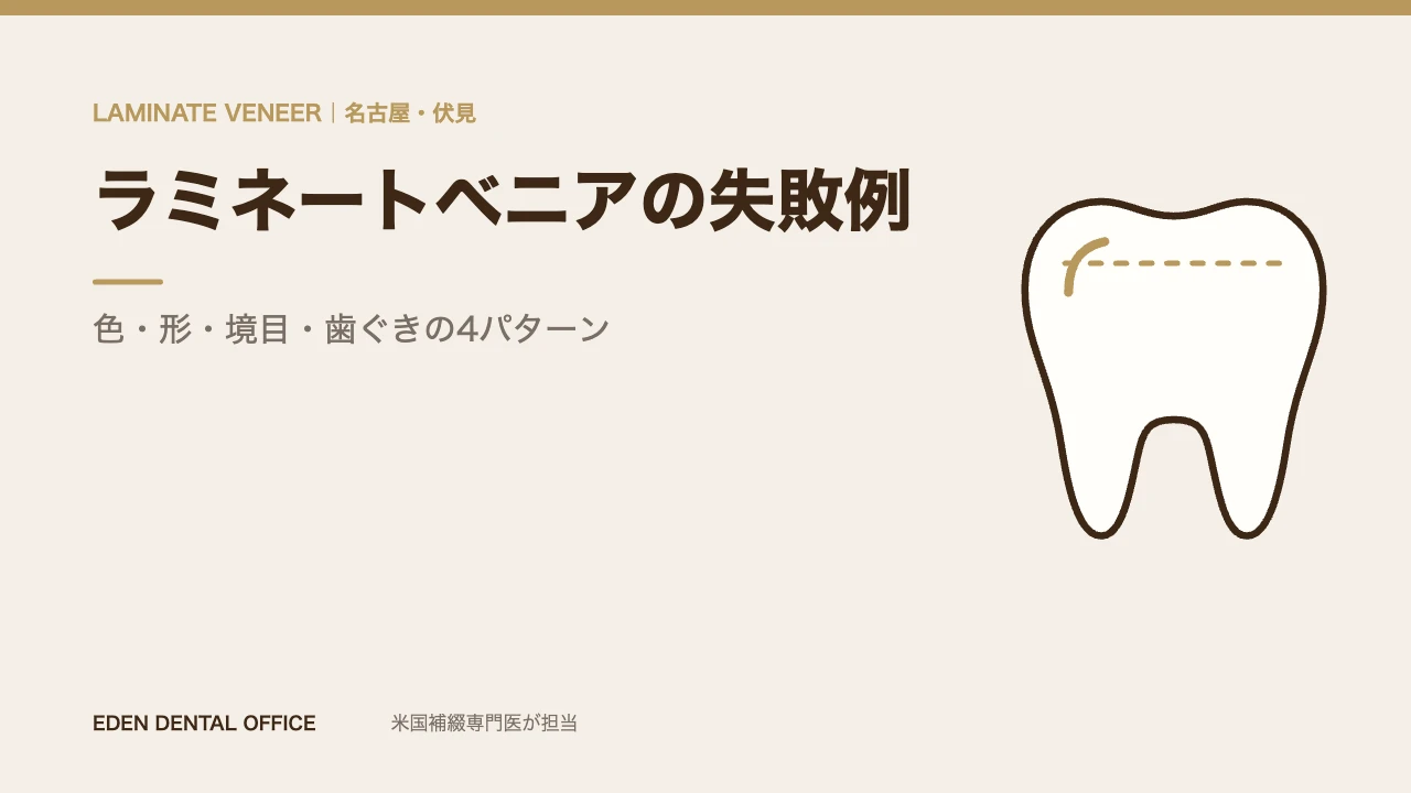 ラミネートベニアの失敗例4パターン|名古屋エデンデンタルオフィス