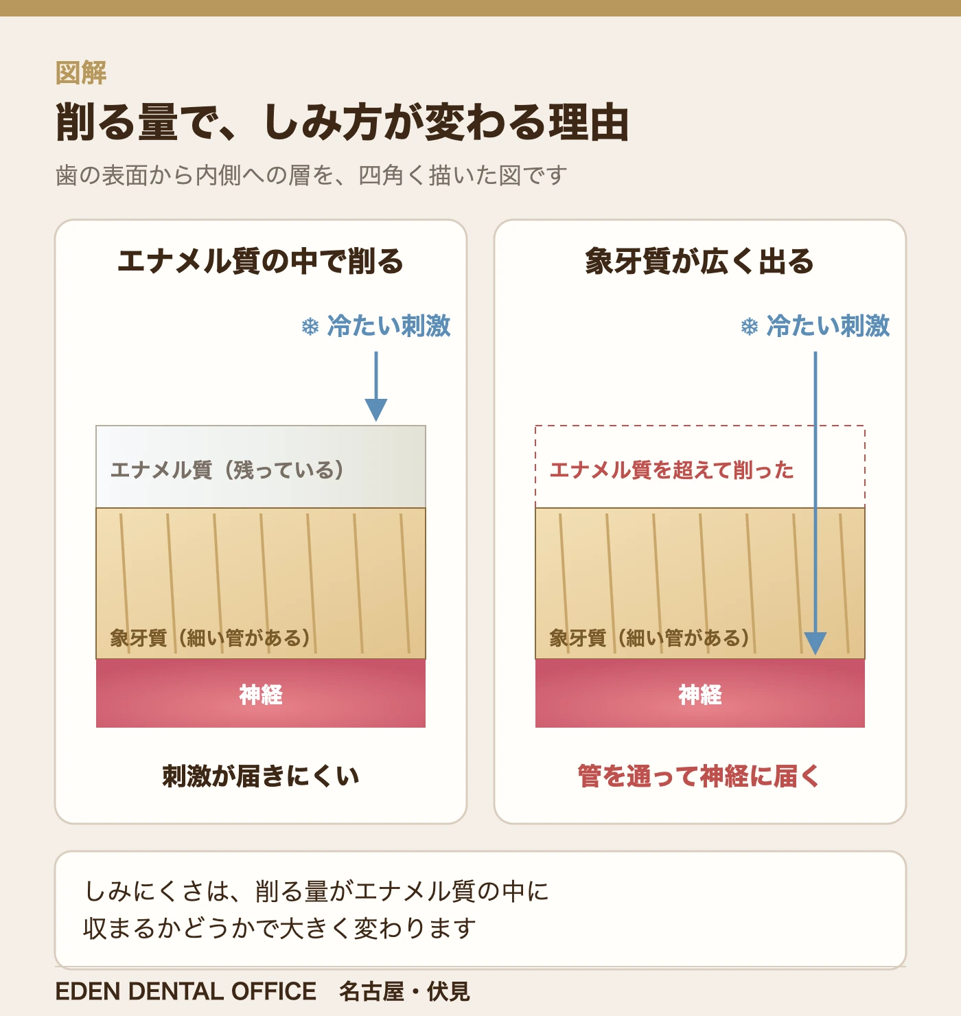 削る量で、しみ方が変わる理由|名古屋エデンデンタルオフィス