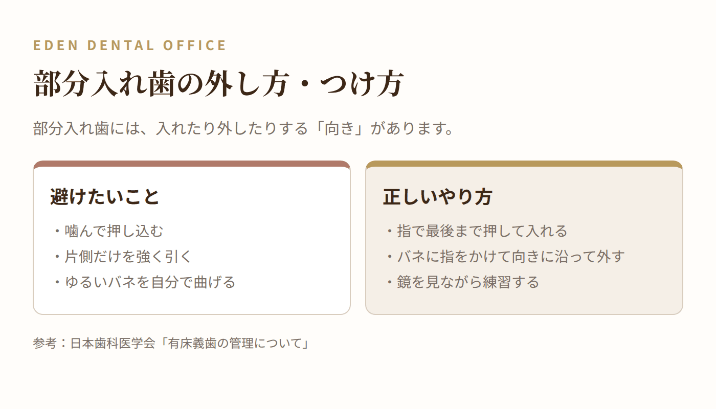 部分入れ歯の外し方・つけ方|名古屋エデンデンタルオフィス