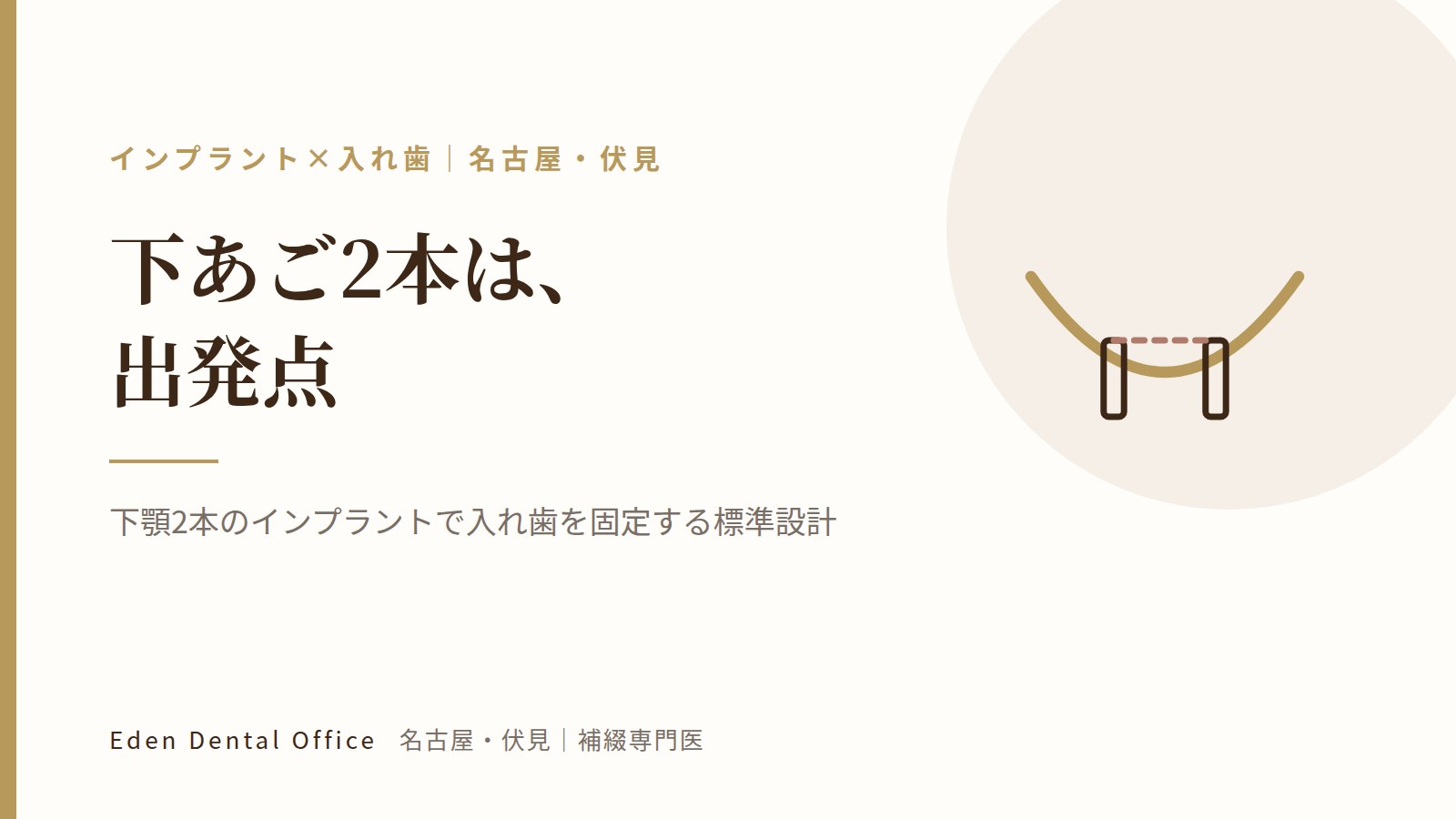 下顎2本のインプラントで入れ歯を固定する標準設計｜名古屋・伏見の補綴専門医