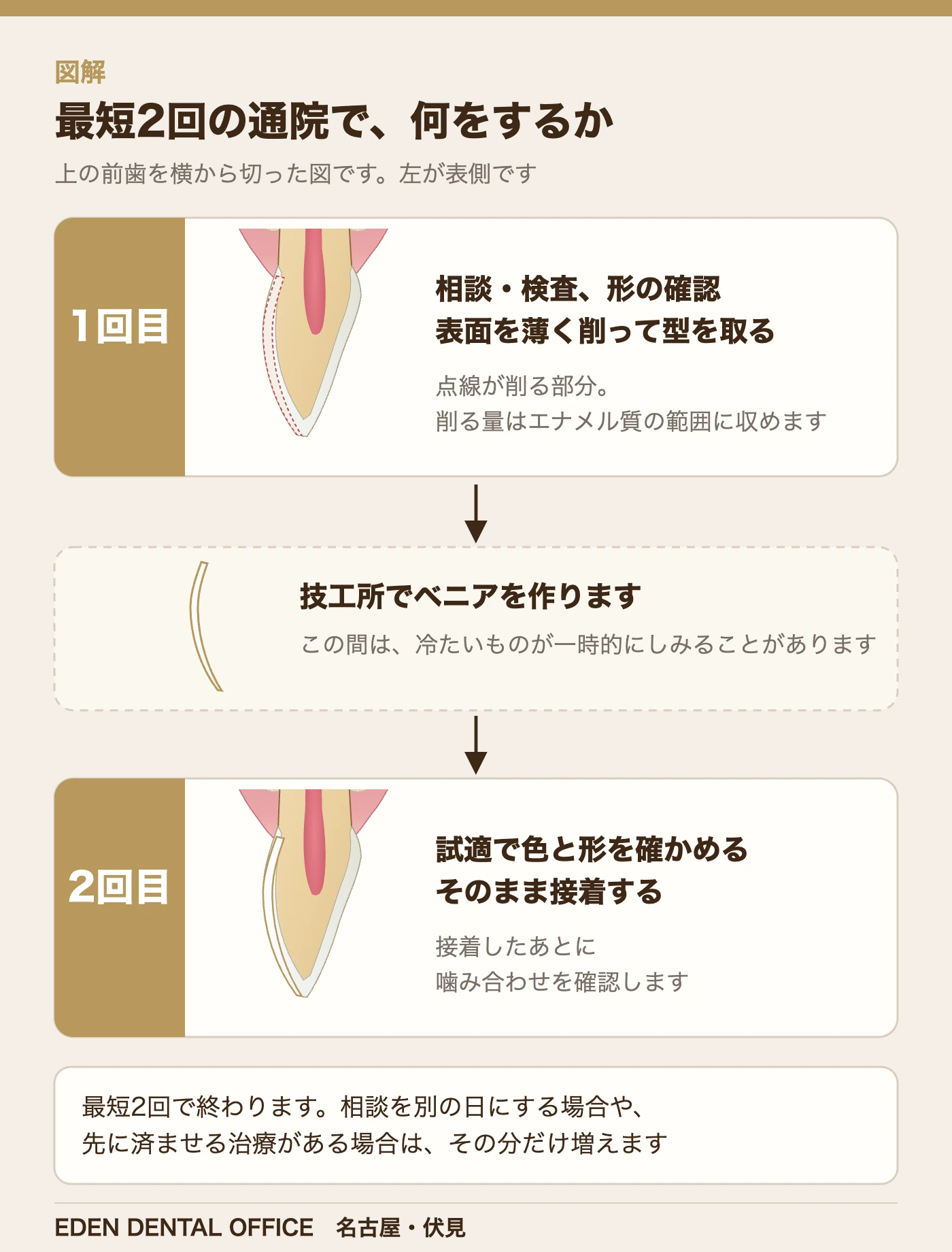 最短2回の通院で、何をするか|名古屋エデンデンタルオフィス
