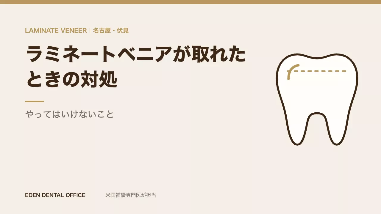 ラミネートベニアが取れたときの対処｜やってはいけないこと