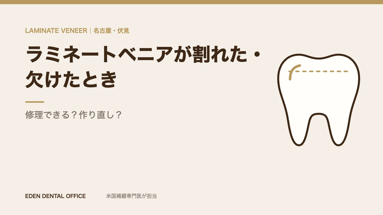 ラミネートベニアが割れた・欠けたときの対応|名古屋エデンデンタルオフィス