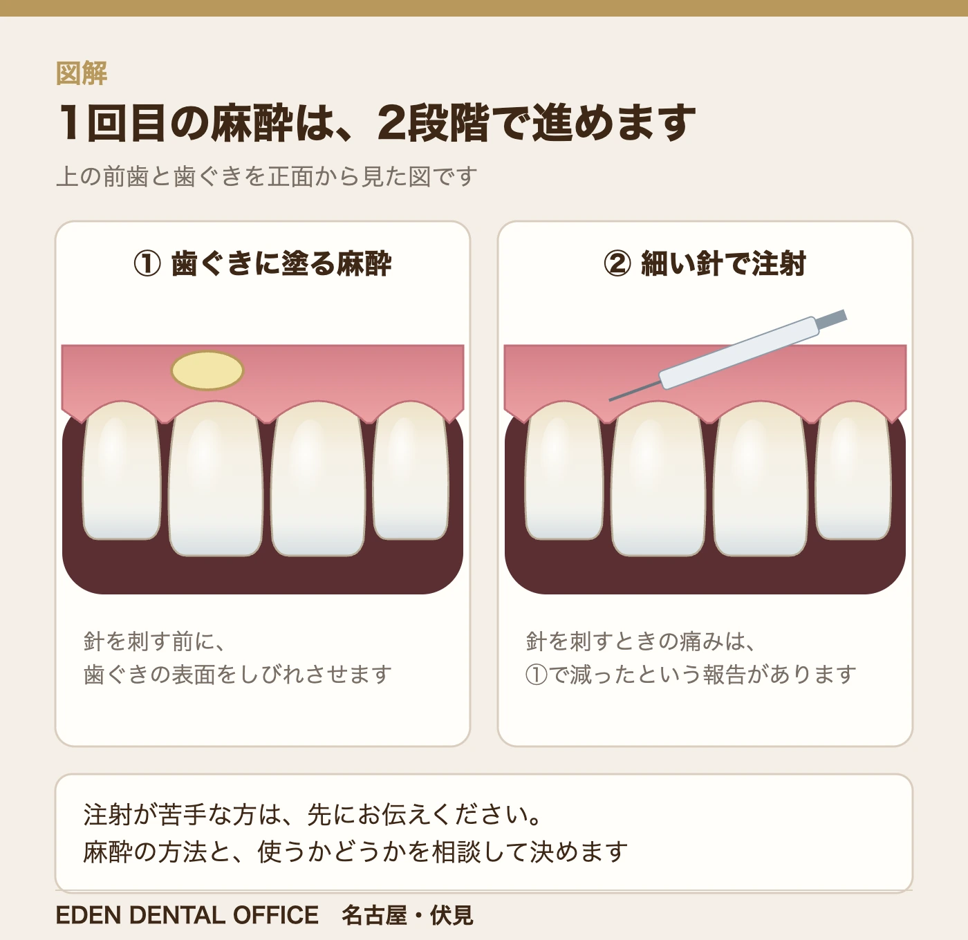 1回目の麻酔は、2段階で進めます|名古屋エデンデンタルオフィス