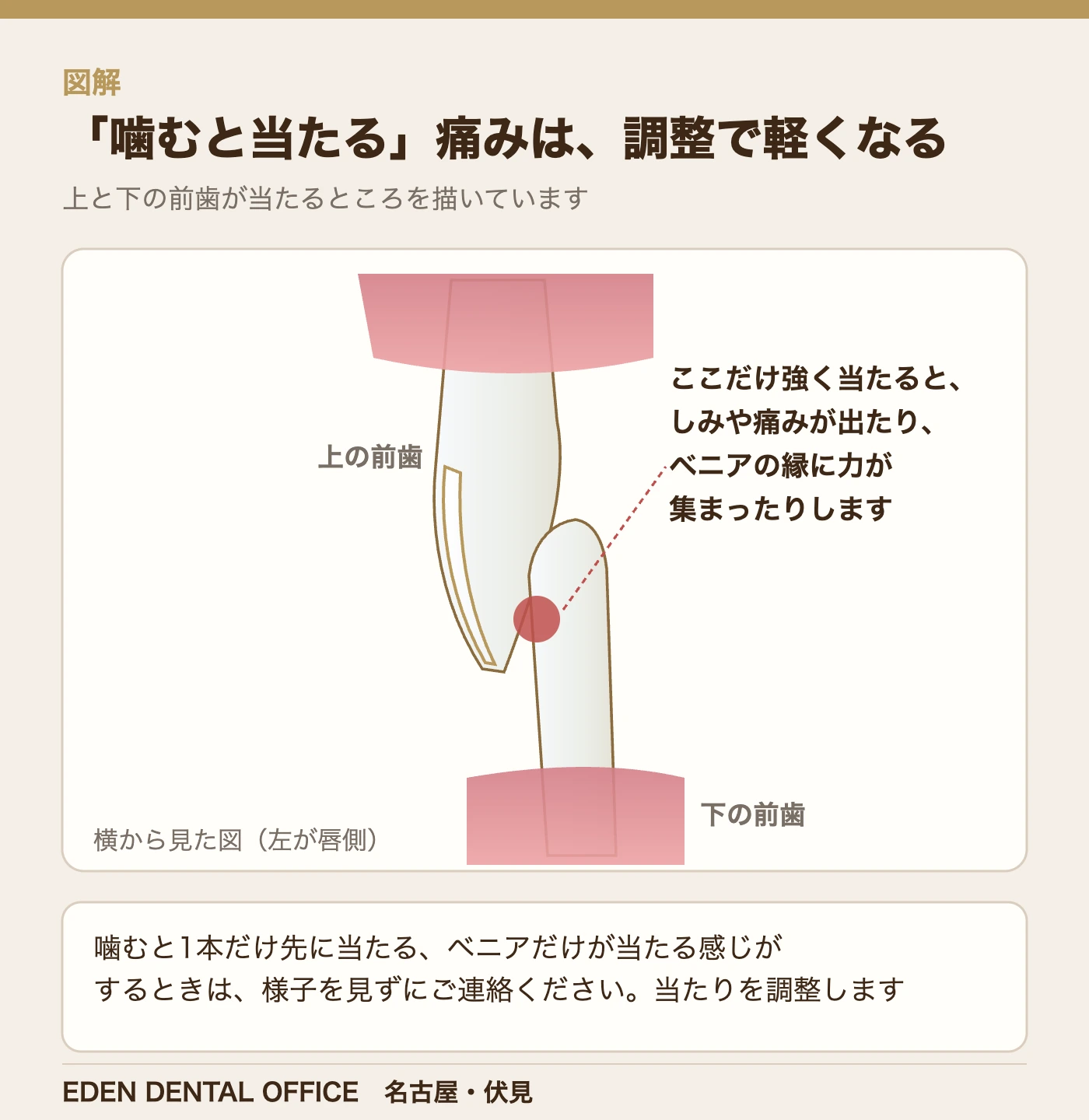 「噛むと当たる」痛みは、調整で軽くなる|名古屋エデンデンタルオフィス